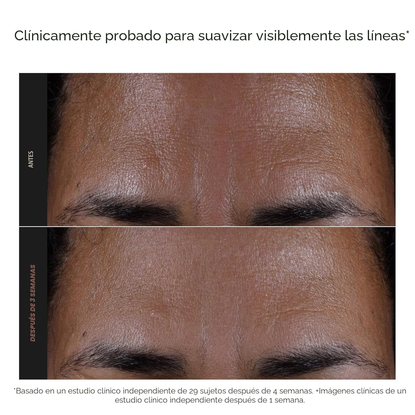 EXFOLIATE- Exfoliante Facial con Acido Salicílico