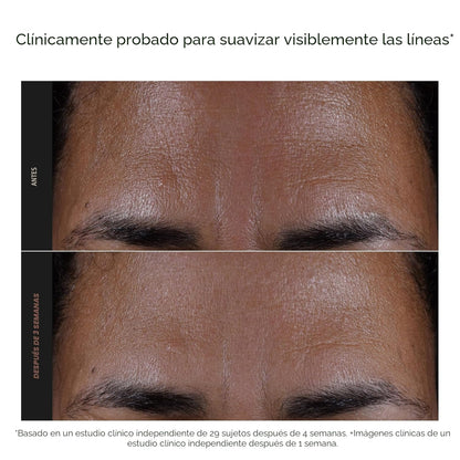 EXFOLIATE- Exfoliante Facial con Acido Salicílico